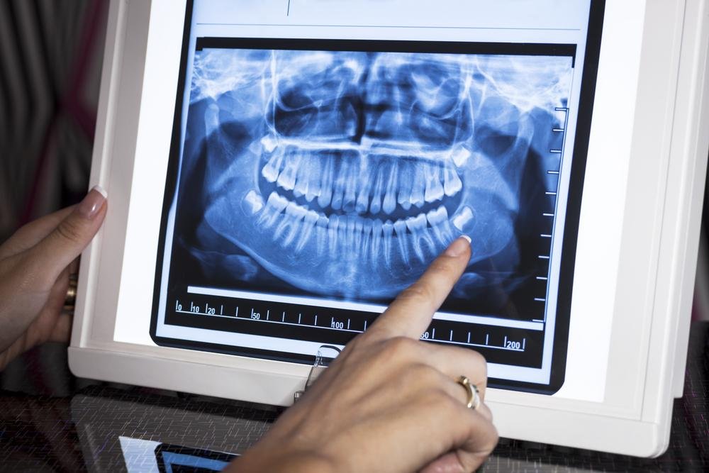 modern dental office in algonquin does digital X-rays for clear images and solve dental issues fast
