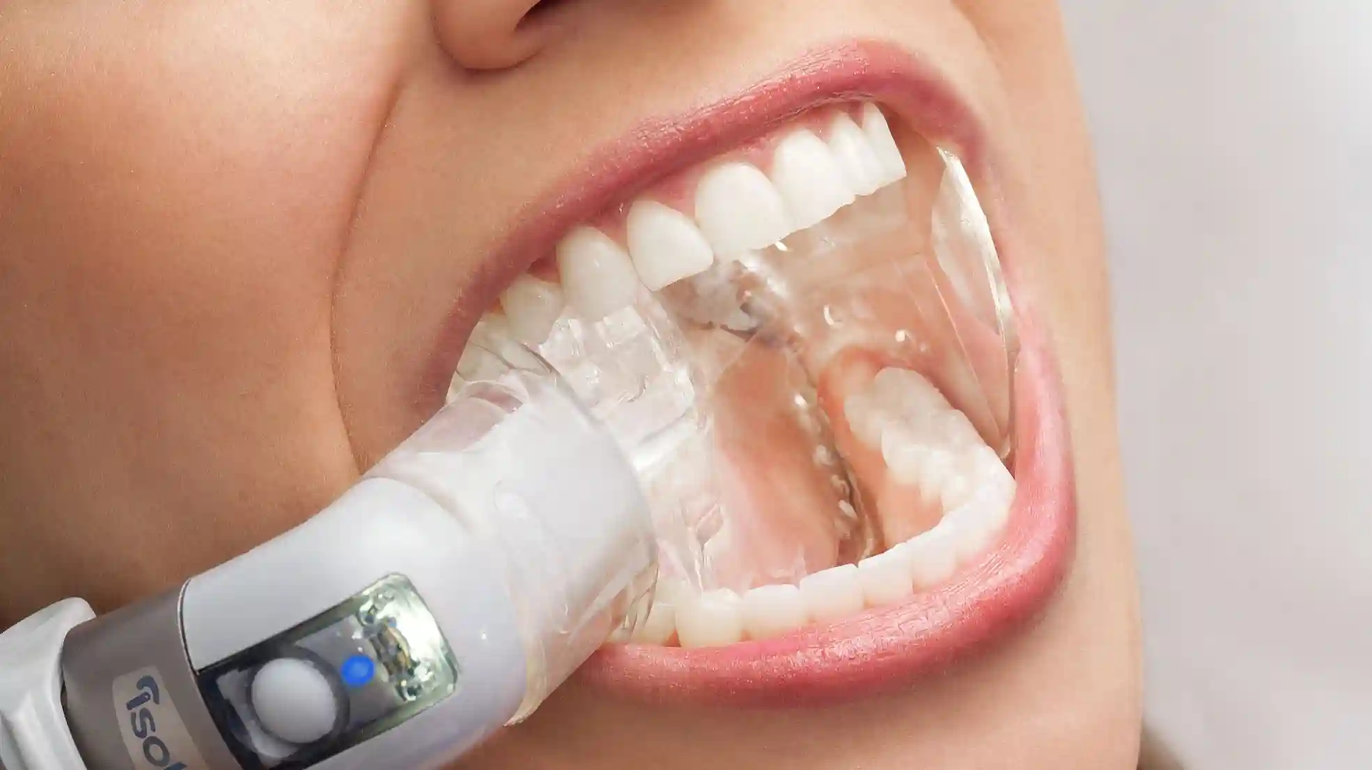 isolte dental system