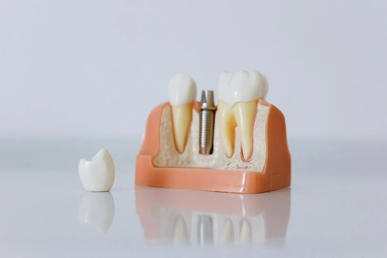 dentist in Algonquin for smile restoration