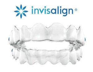 Invisalign Clear Aligners and traditional braces for kids and teens in Algonquin IL