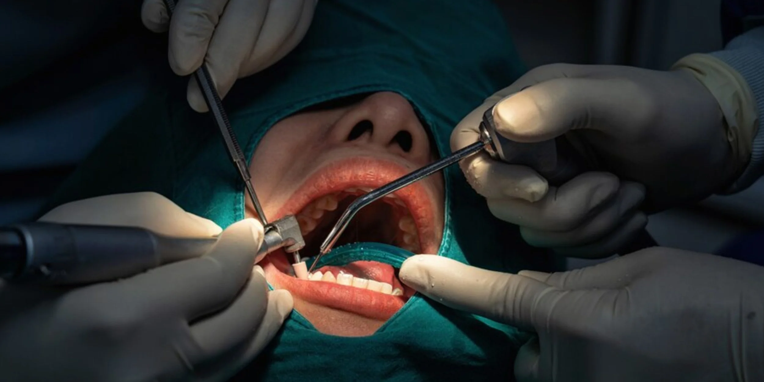 oral surgery and extractions in Algonquin, IL for children and adults