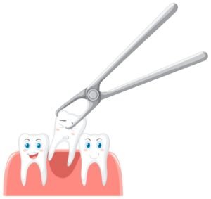 tooth extraction dentist in Algonquin, IL for adults and children