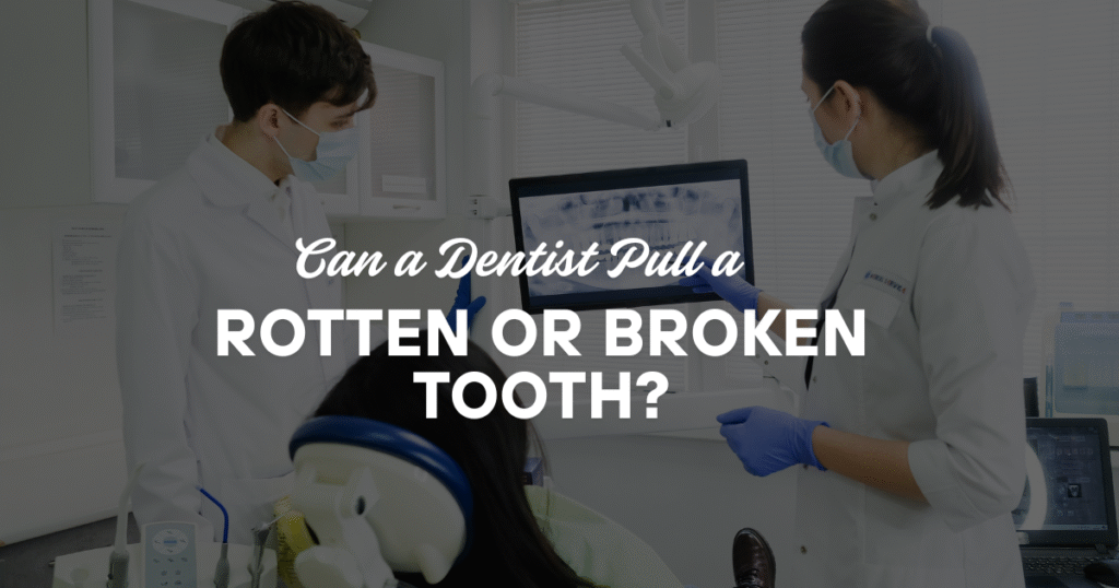 Dentist reviewing a dental X-ray with a patient to evaluate a rotten or broken tooth before recommending tooth extraction or restorative treatment.