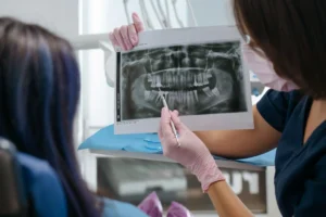 Dentist explaining a dental X-ray to a patient during an examination to evaluate a rotten or broken tooth before tooth extraction treatment.